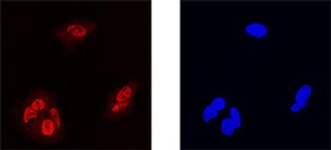 MAFF Antibody in Immunocytochemistry (ICC/IF)