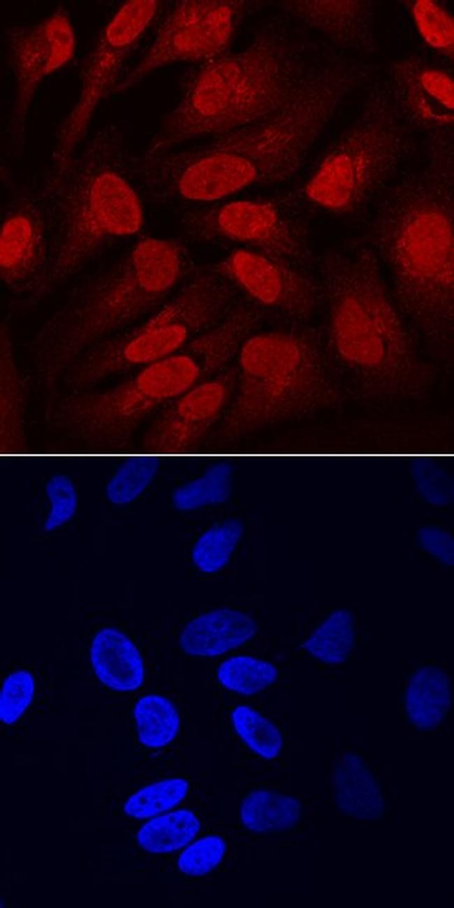 SOX11 Antibody in Immunocytochemistry (ICC/IF)