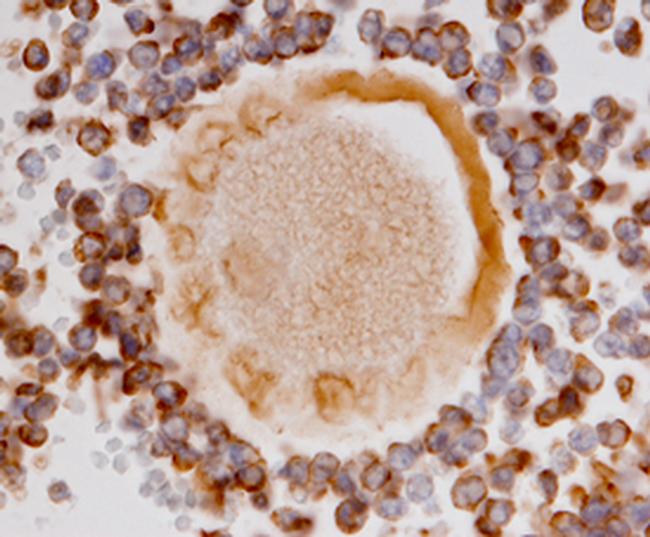 AMHR2 Antibody in Immunohistochemistry (Paraffin) (IHC (P))