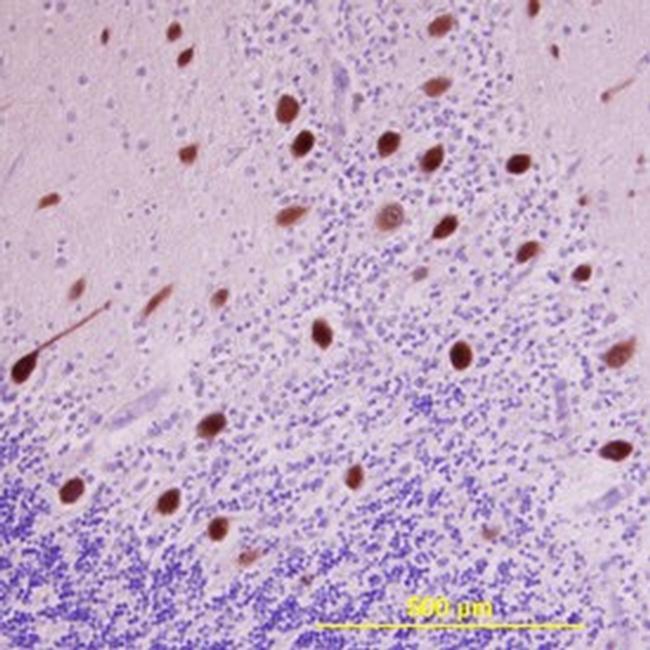 LRRC4 Antibody in Immunohistochemistry (Paraffin) (IHC (P))