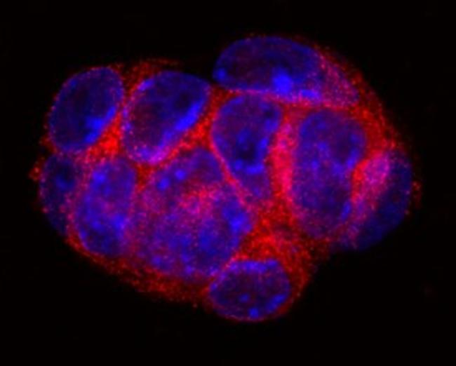 5T4 Antibody in Immunocytochemistry (ICC/IF)