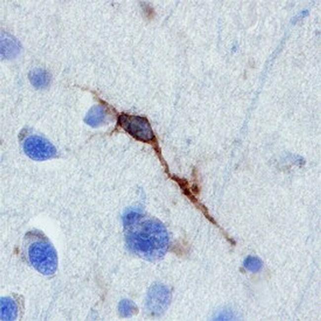 NLGN4X Antibody in Immunohistochemistry (Paraffin) (IHC (P))