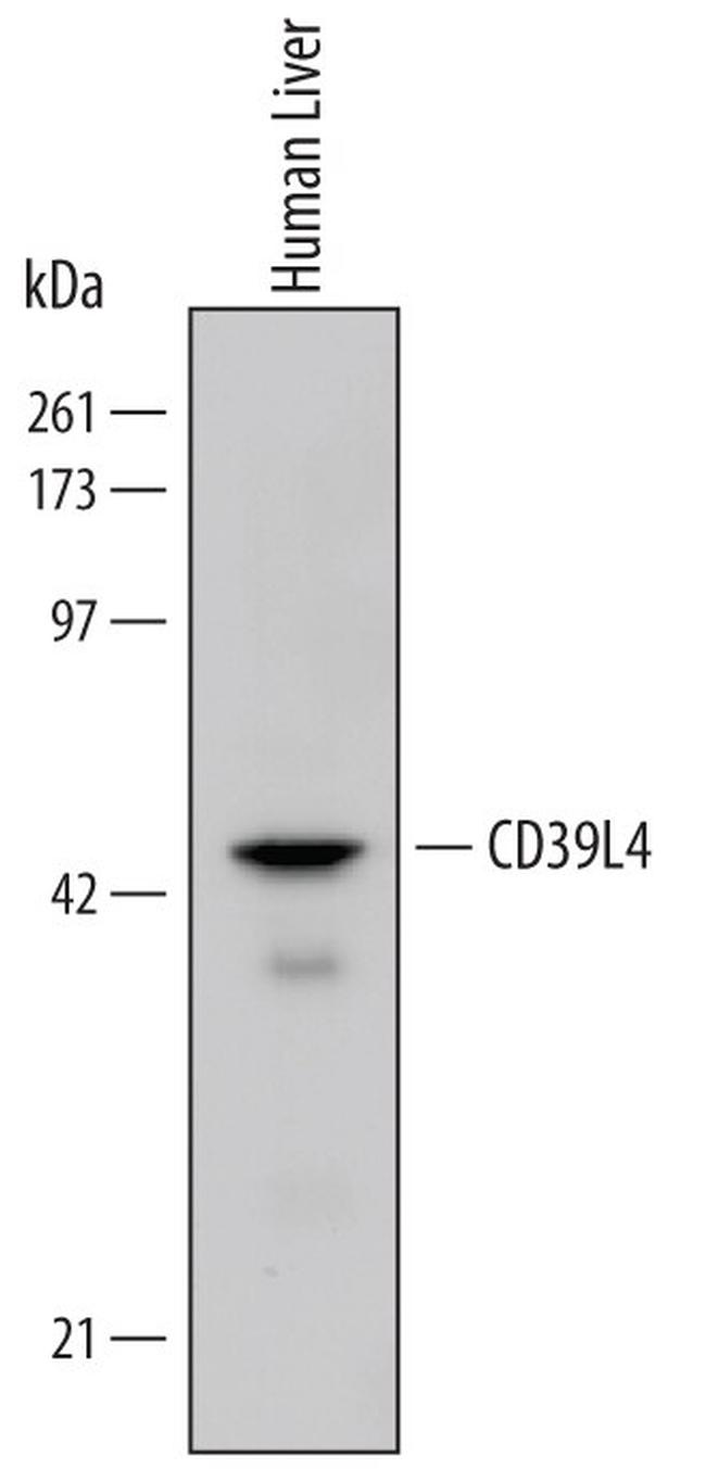 ENTPD5 Antibody in Western Blot (WB)