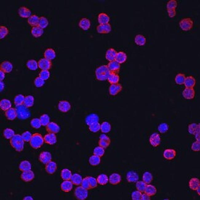 Il13ra2 Antibody in Immunocytochemistry (ICC/IF)