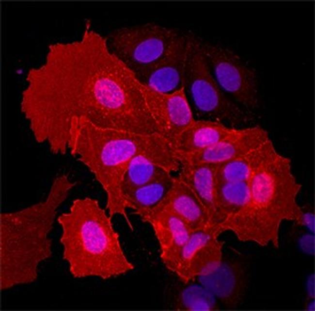 EphA5 Antibody in Immunocytochemistry (ICC/IF)