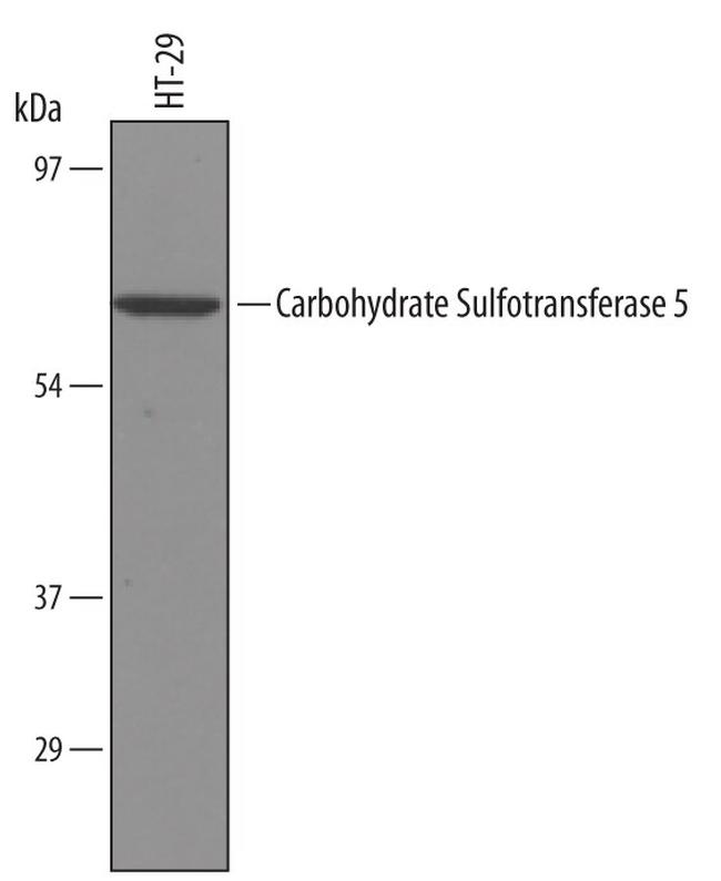 CHST5 Antibody in Western Blot (WB)