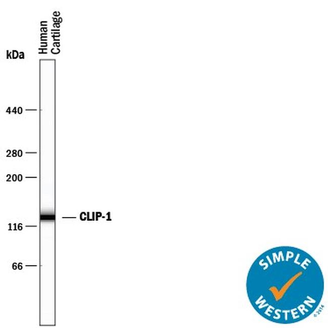 CILP Antibody in Western Blot (WB)