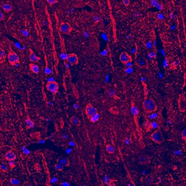 Neuropilin 2 Antibody in Immunohistochemistry (Frozen) (IHC (F))