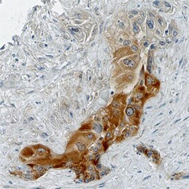 BTF3 Antibody in Immunohistochemistry (Paraffin) (IHC (P))