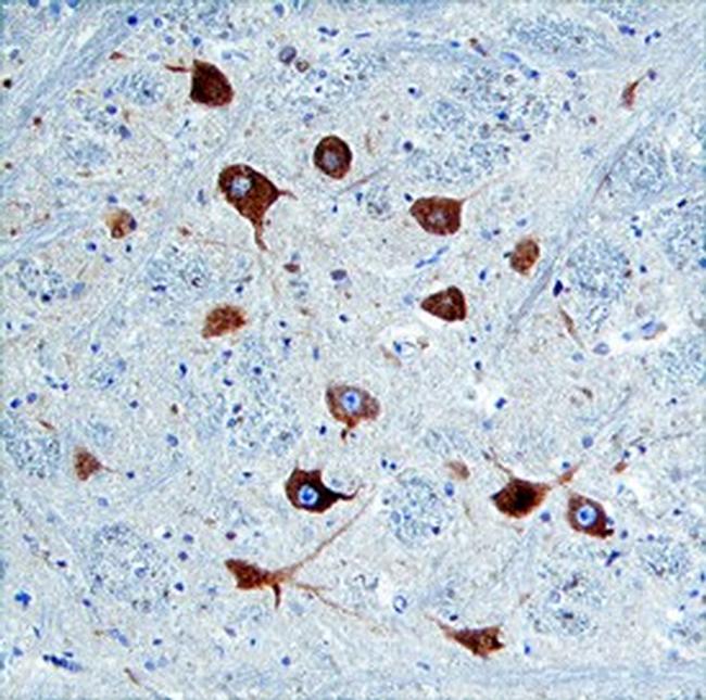 Nogo-C Antibody in Immunohistochemistry (Paraffin) (IHC (P))