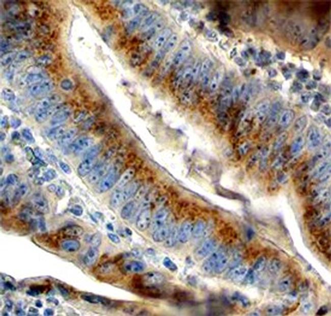 FUT8 Antibody in Immunohistochemistry (Paraffin) (IHC (P))