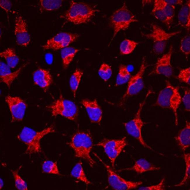 SEMA4C Antibody in Immunocytochemistry (ICC/IF)