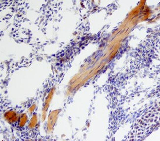 BMP-6 Antibody in Immunohistochemistry (Frozen) (IHC (F))