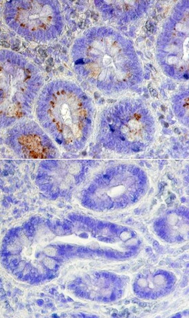 ASCL2 Antibody in Immunohistochemistry (Paraffin) (IHC (P))