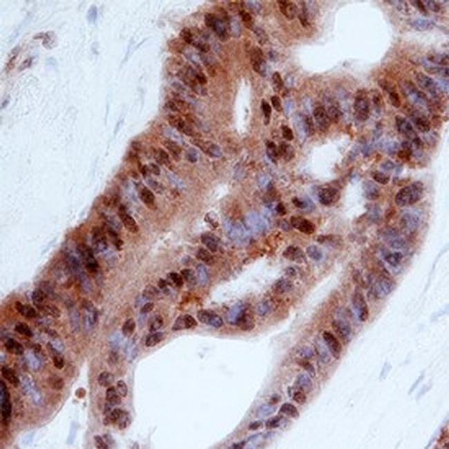 ITGB1BP1 Antibody in Immunohistochemistry (Paraffin) (IHC (P))