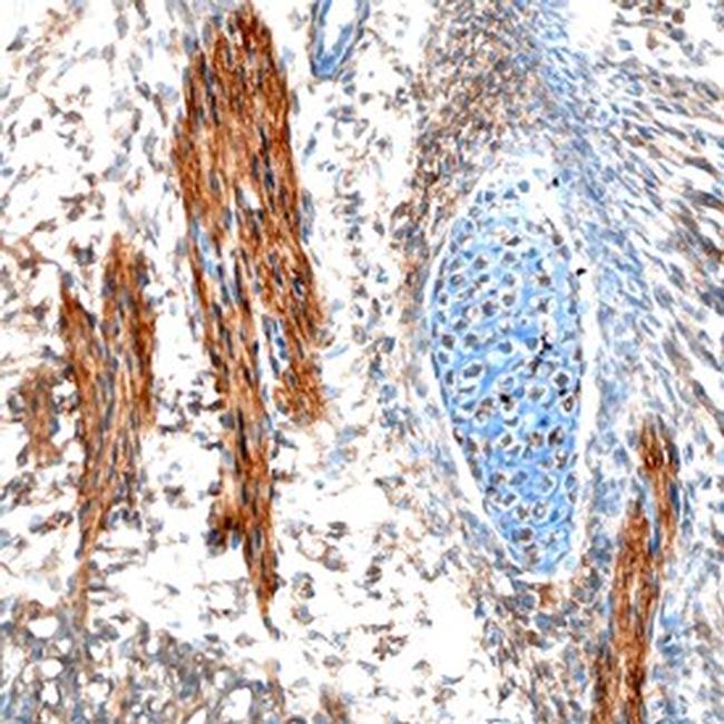 EBF2 Antibody in Immunohistochemistry (Frozen) (IHC (F))