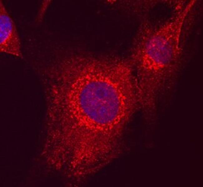 MAGI2 Antibody in Immunocytochemistry (ICC/IF)