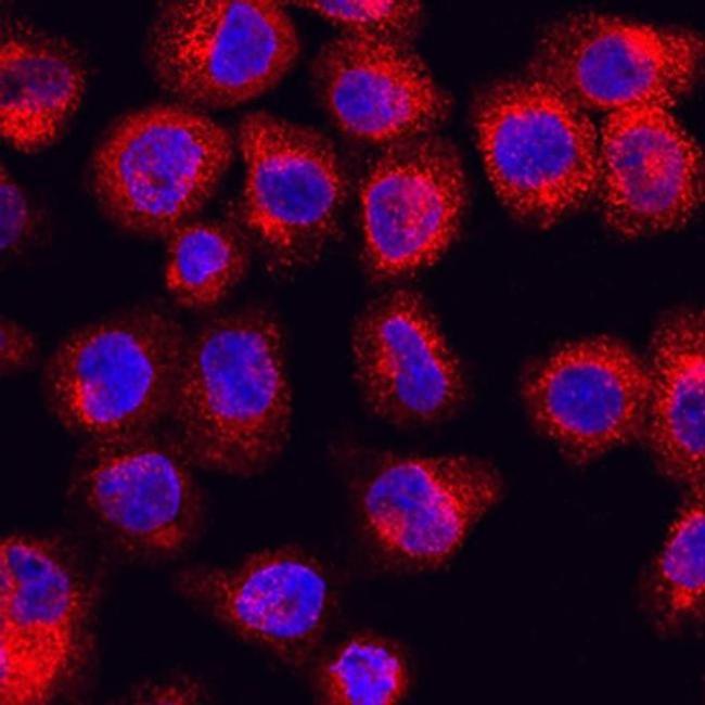 RAB27A Antibody in Immunocytochemistry (ICC/IF)