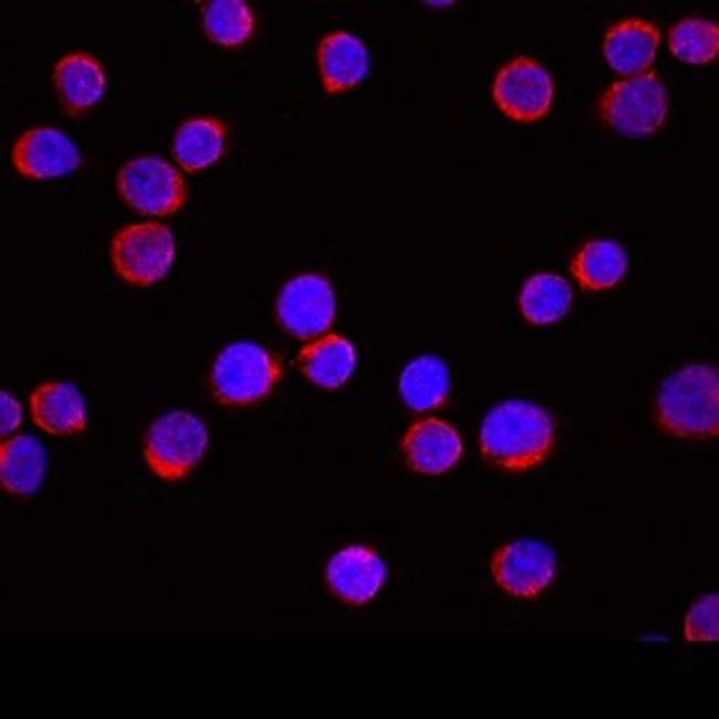 EMP Antibody in Immunocytochemistry (ICC/IF)