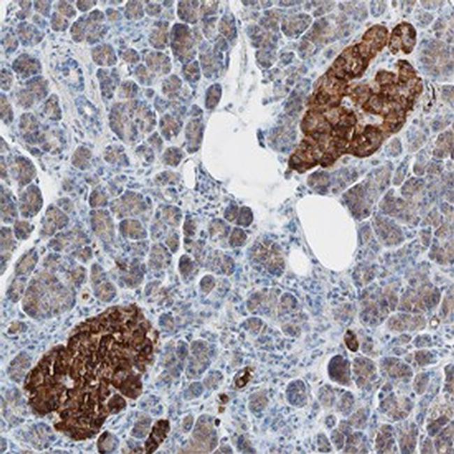 SLC30A8 Antibody in Immunohistochemistry (Paraffin) (IHC (P))