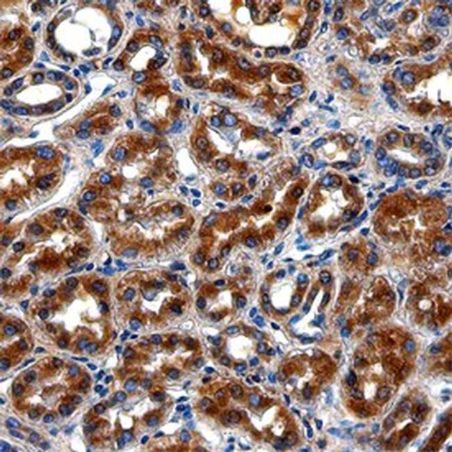 LRIG1 Antibody in Immunohistochemistry (Paraffin) (IHC (P))