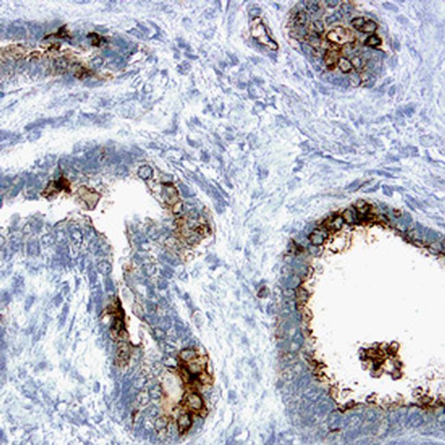 BMPR2 Antibody in Immunohistochemistry (Paraffin) (IHC (P))