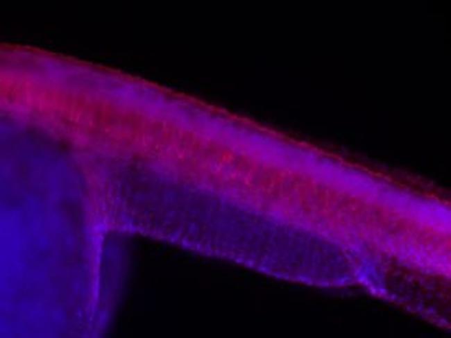 TIE2 Antibody in Immunohistochemistry (Paraffin) (IHC (P))