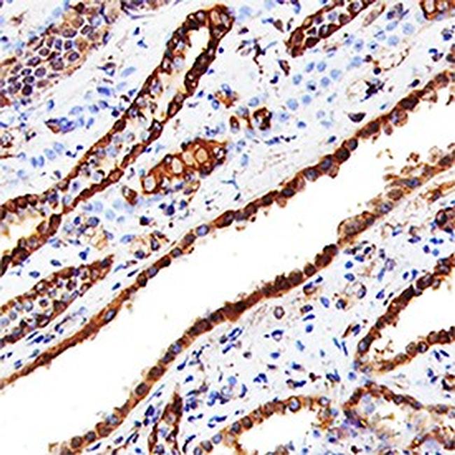 Cathepsin L Antibody in Immunohistochemistry (Paraffin) (IHC (P))