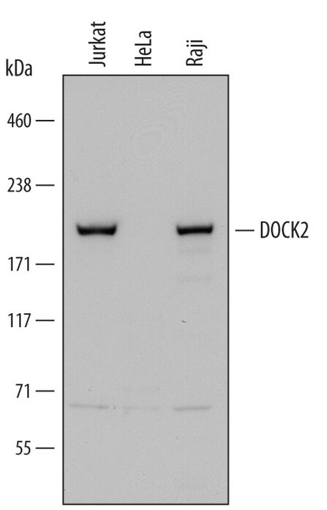 DOCK2 Antibody in Western Blot (WB)