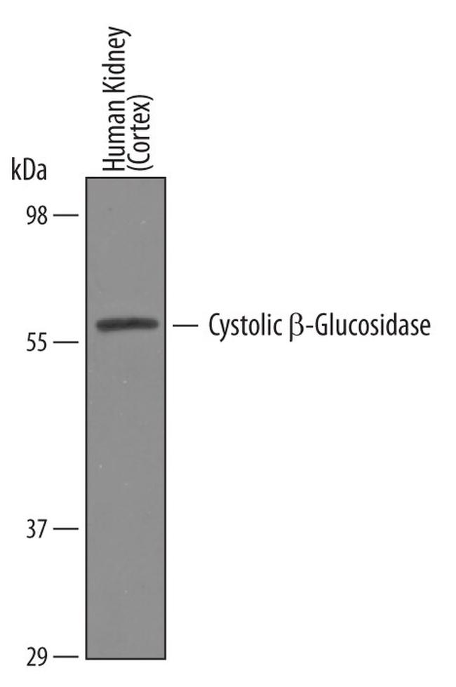 GBA3 Antibody in Western Blot (WB)