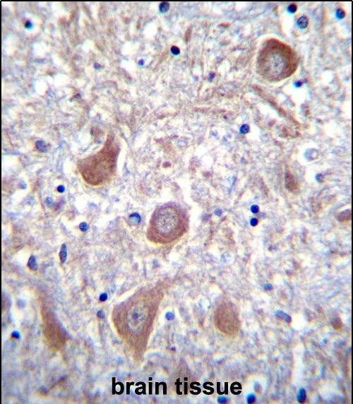 PTCHD1 Antibody in Immunohistochemistry (Paraffin) (IHC (P))