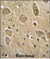 UGT8 Antibody in Immunohistochemistry (Paraffin) (IHC (P))