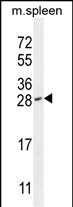 IAH1 Antibody in Western Blot (WB)