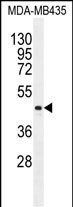 LIPK Antibody in Western Blot (WB)