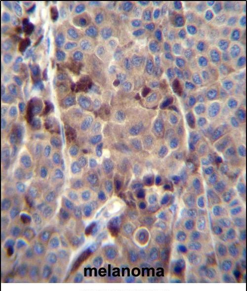 PRAMEF8 Antibody in Immunohistochemistry (Paraffin) (IHC (P))