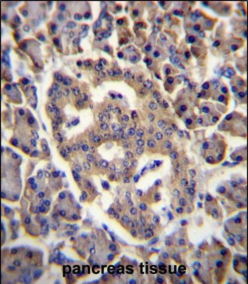 SPNS3 Antibody in Immunohistochemistry (Paraffin) (IHC (P))