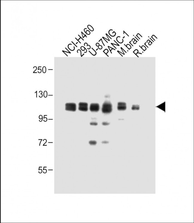 XYLT1 Antibody in Western Blot (WB)