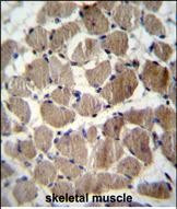 COCH Antibody in Immunohistochemistry (Paraffin) (IHC (P))