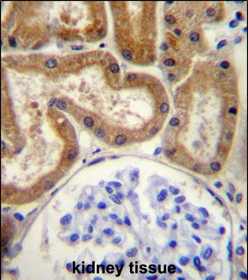 FGD2 Antibody in Immunohistochemistry (Paraffin) (IHC (P))