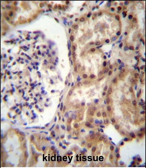 RNF43 Antibody in Immunohistochemistry (Paraffin) (IHC (P))