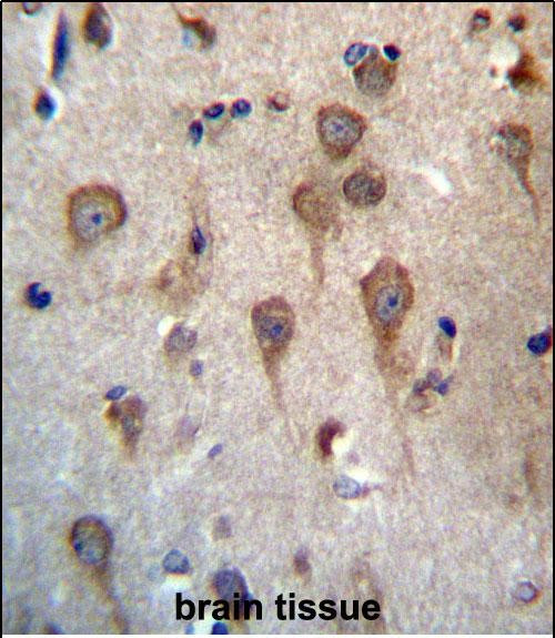 GPHB5 Antibody in Immunohistochemistry (Paraffin) (IHC (P))