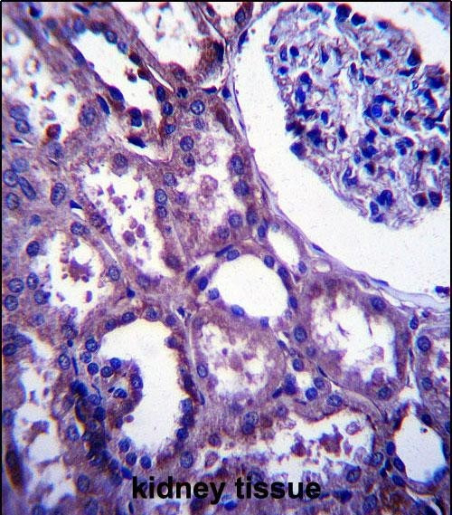 EMP2 Antibody in Immunohistochemistry (Paraffin) (IHC (P))