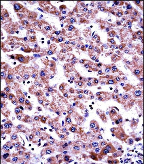 GDI2 Antibody in Immunohistochemistry (Paraffin) (IHC (P))