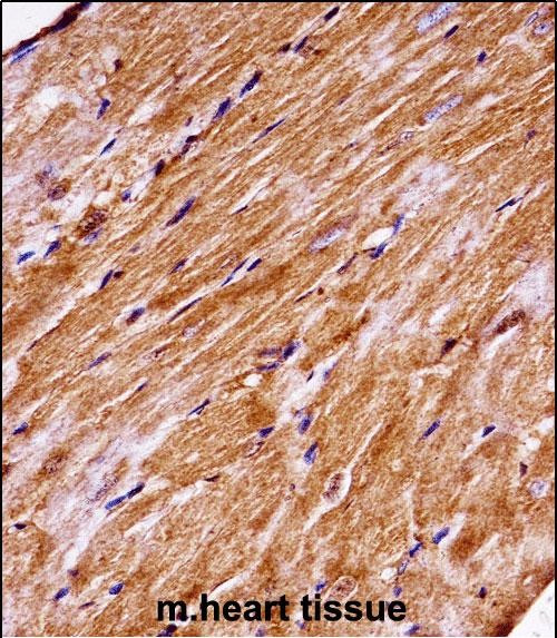 MAP4K3 Antibody in Immunohistochemistry (Paraffin) (IHC (P))