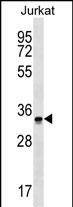 OR2G6 Antibody in Western Blot (WB)