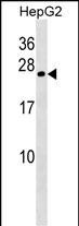 CRYGB Antibody in Western Blot (WB)