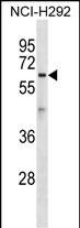 ATL1 Antibody in Western Blot (WB)