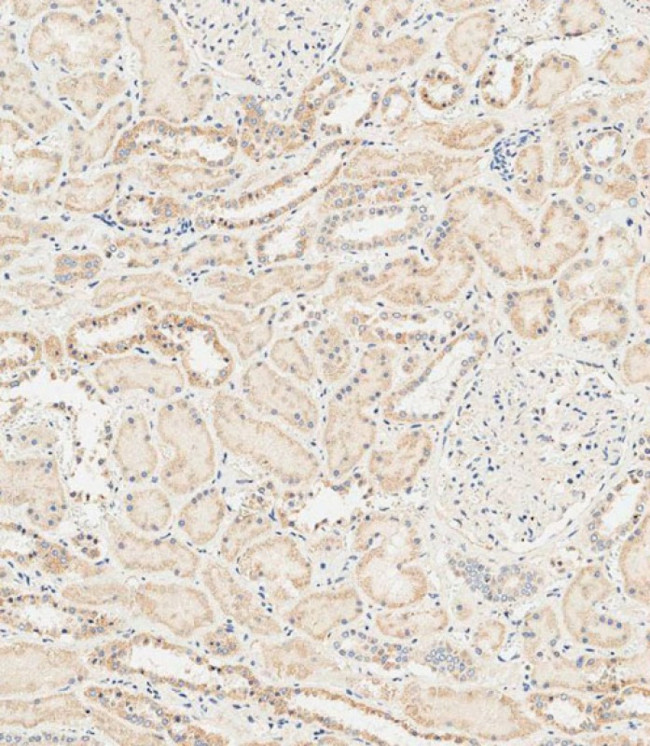 RAB28 Antibody in Immunohistochemistry (Paraffin) (IHC (P))