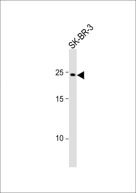 RAB32 Antibody in Western Blot (WB)