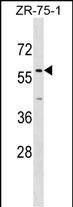 ZNF10 Antibody in Western Blot (WB)